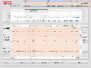 MD10136_3.webp