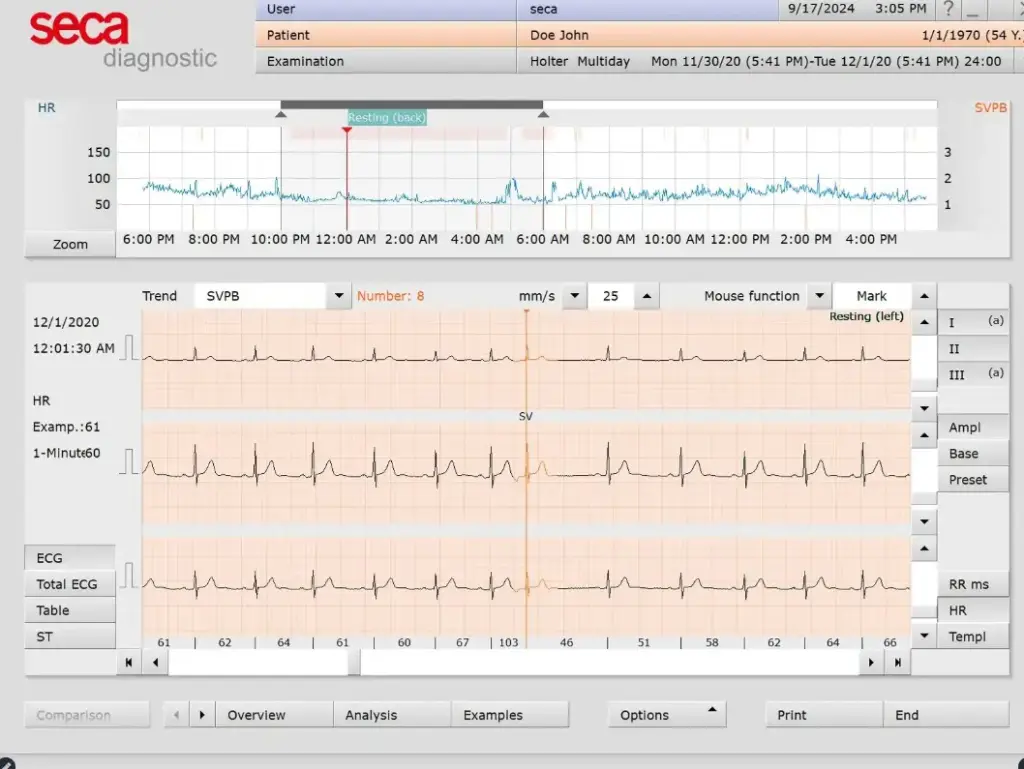 Seca Guard Holter Software