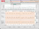 Seca Guard Holter Software