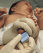 [MD03525] Tenderfoot Full Term Lancet - Newborn x 50