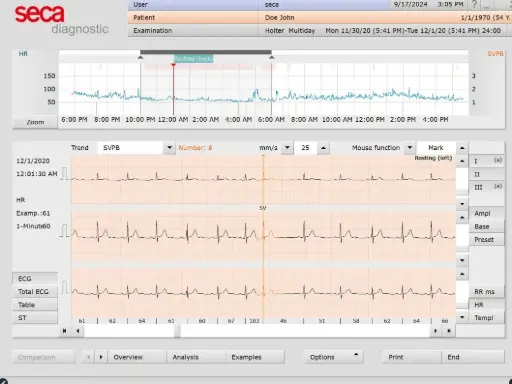 [MD10332] Seca Guard Holter Software